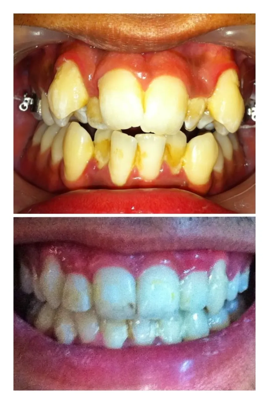 Happy-Patients-2