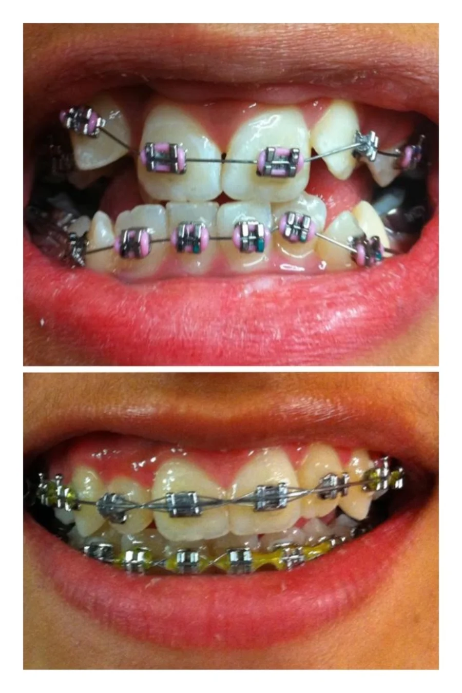 Happy-Patients-3