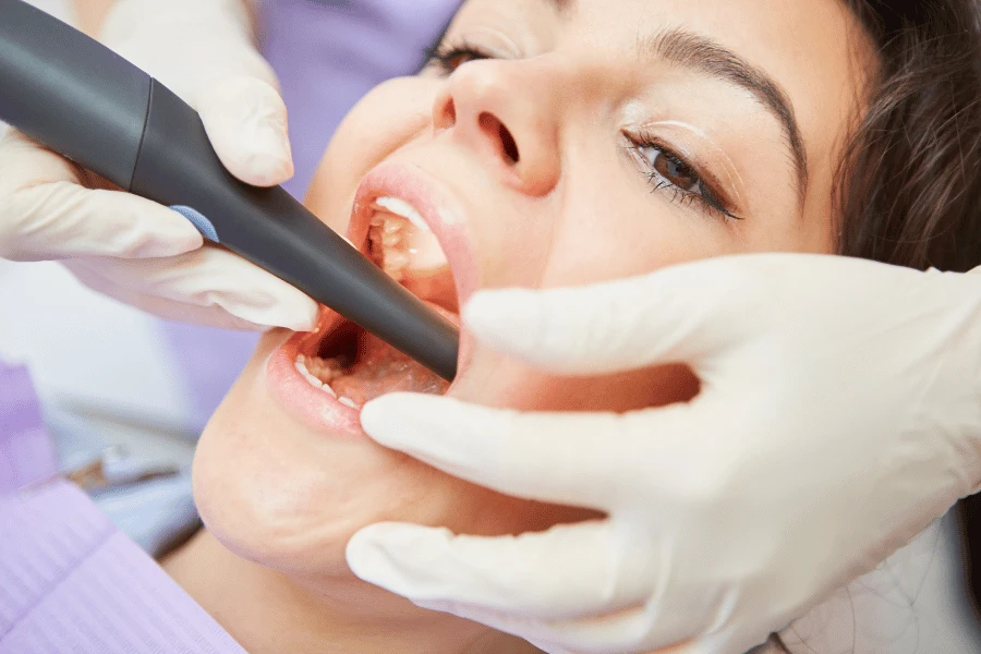 Root Canal