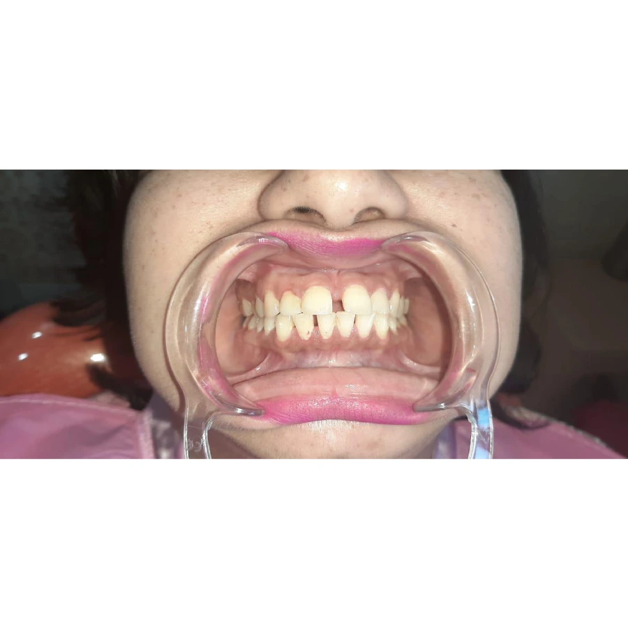 Smile-Bright-1