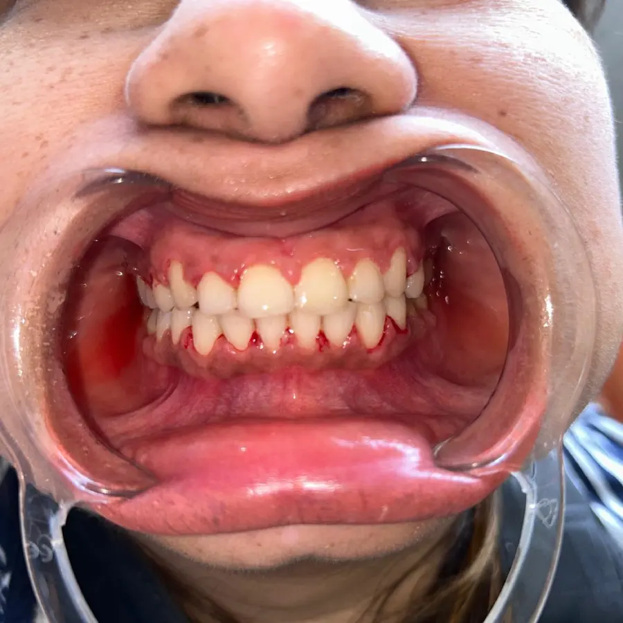 Smile-Bright