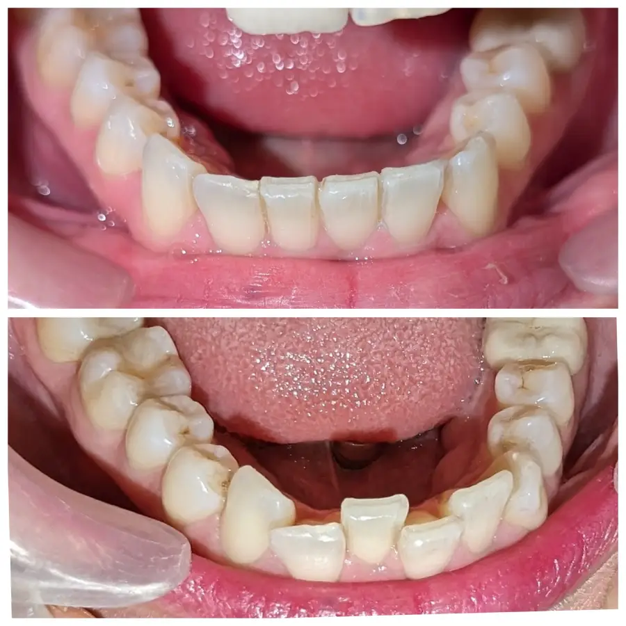 Smile-Right-Patientswebp-1