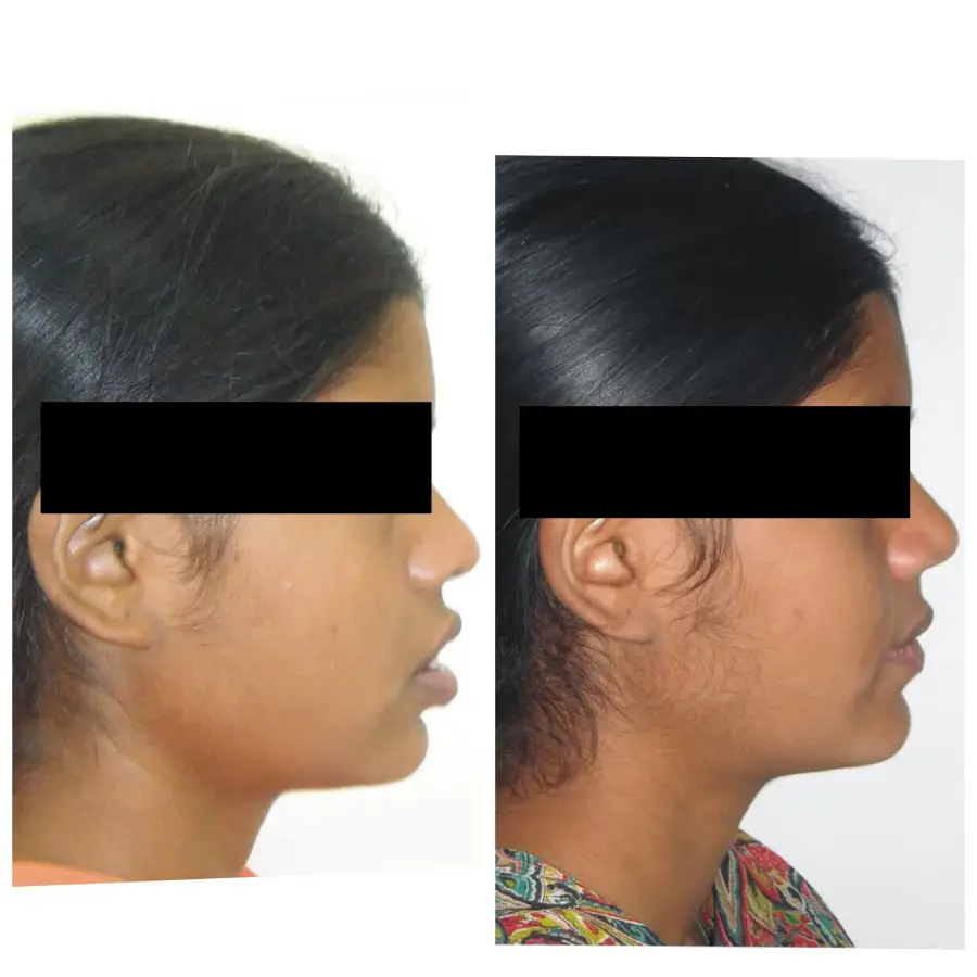 Smile-Right-Patientswebp-2
